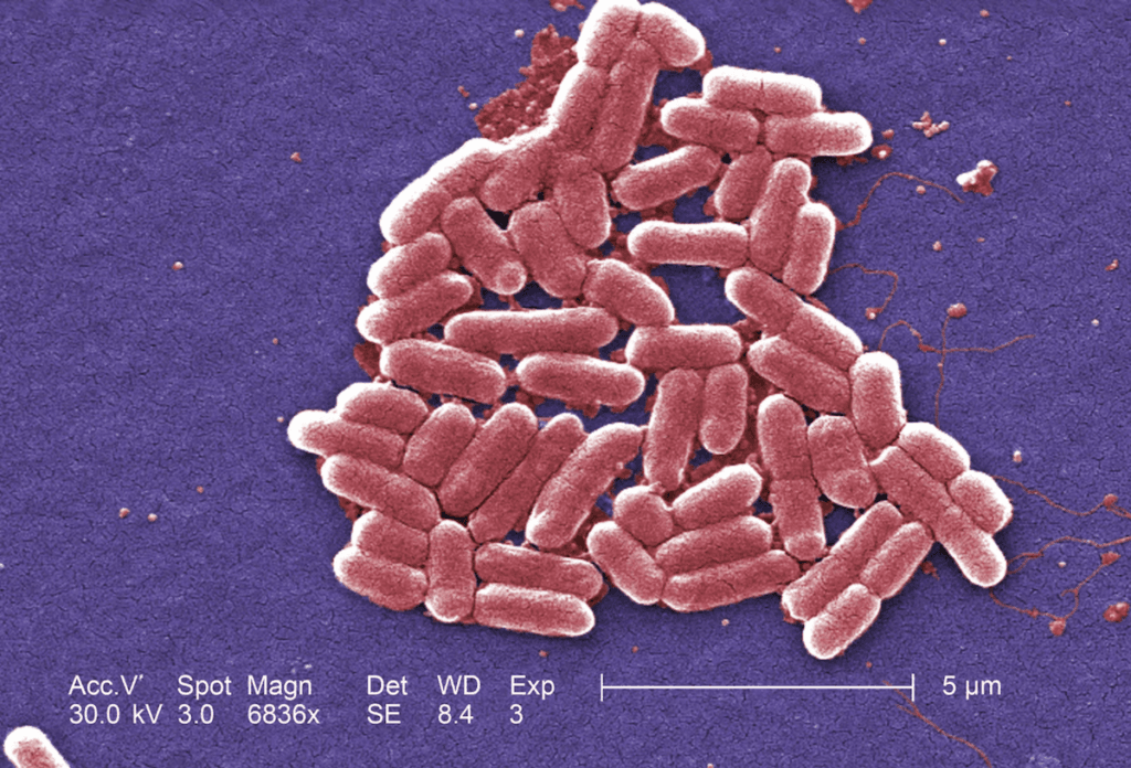 Scanning electron micrograph showing a cluster of E. coli bacteria linked to foodborne contamination. Publix E. coli Outbreak